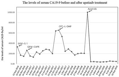 Remarkable Response of Metastatic Gallbladder Carcinoma to Apatinib After Failed Multiline Chemotherapies: A Case Report and Literature Review